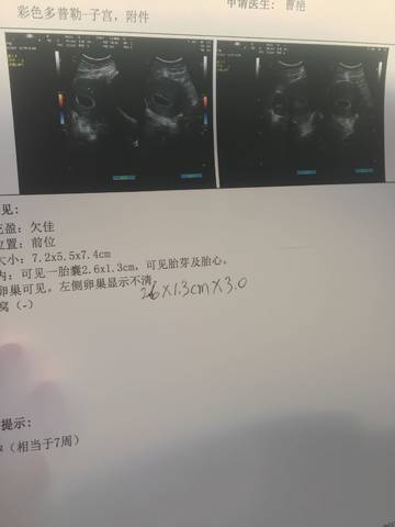 journal_insert_pic_916077125