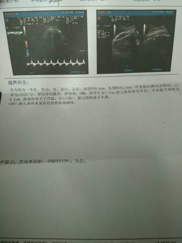 journal_insert_pic_916627589