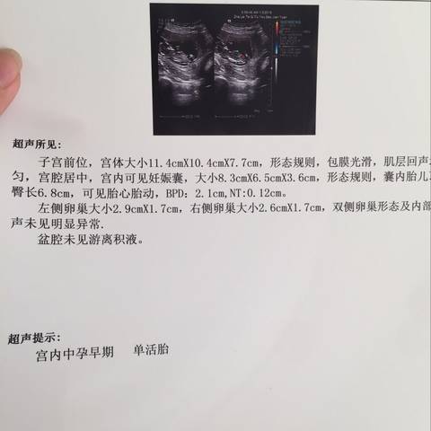 journal_insert_pic_917970930