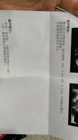 journal_insert_pic_918912271