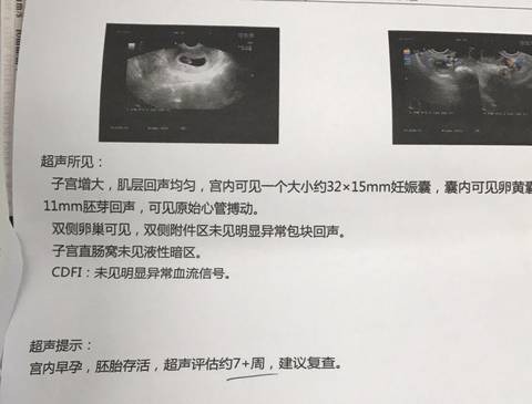 journal_insert_pic_921204048