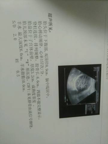journal_insert_pic_920702610