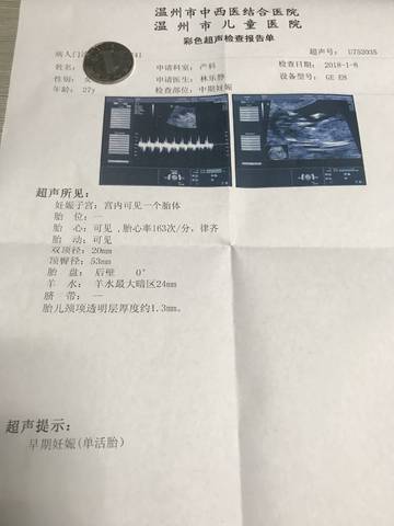 journal_insert_pic_921458082