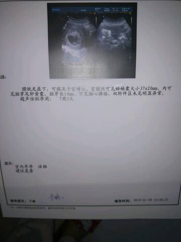 journal_insert_pic_922225056