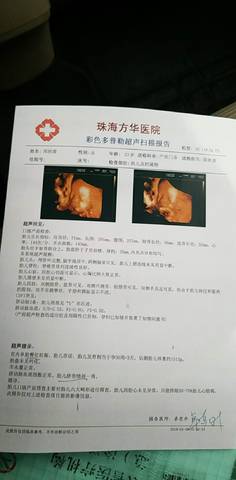 journal_insert_pic_923352856