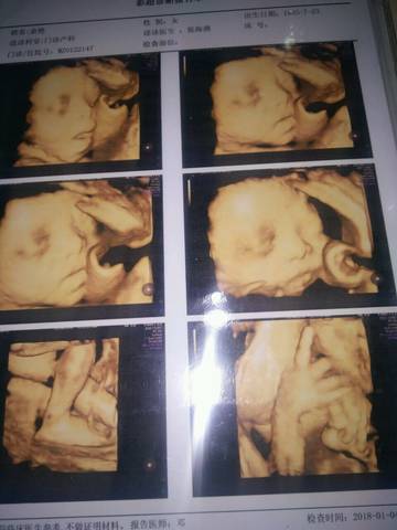 journal_insert_pic_923973552