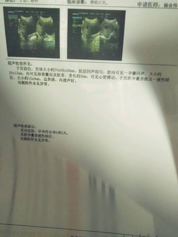 journal_insert_pic_924014021