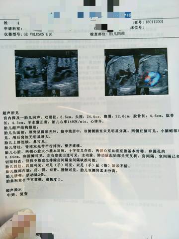 journal_insert_pic_923840466