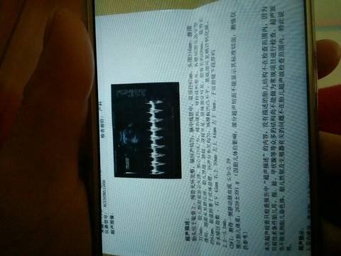 journal_insert_pic_925892599