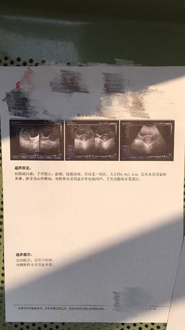 journal_insert_pic_927877465