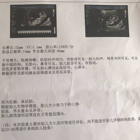 journal_insert_pic_927755031