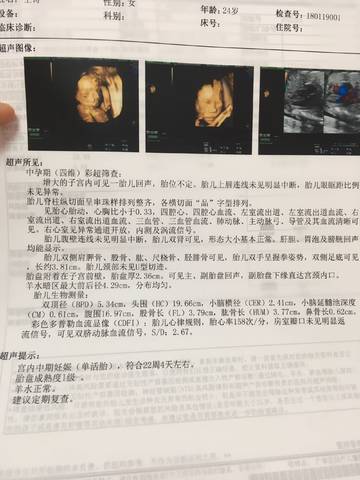 journal_insert_pic_928772810