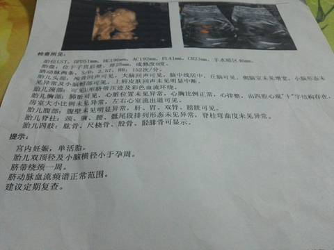 journal_insert_pic_928707959