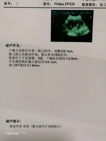 journal_insert_pic_928486443
