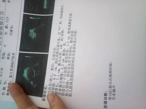 journal_insert_pic_931936466