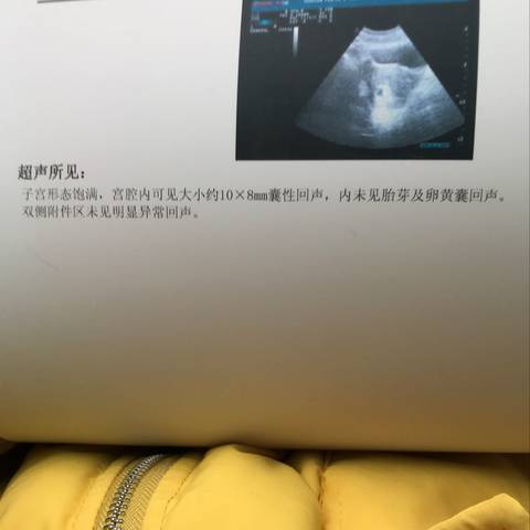 journal_insert_pic_931671757