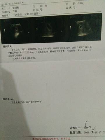 journal_insert_pic_935679450