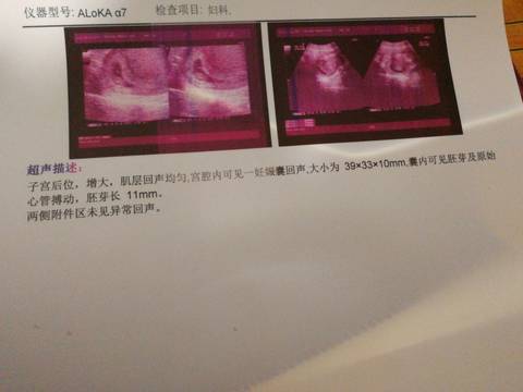 journal_insert_pic_936928362