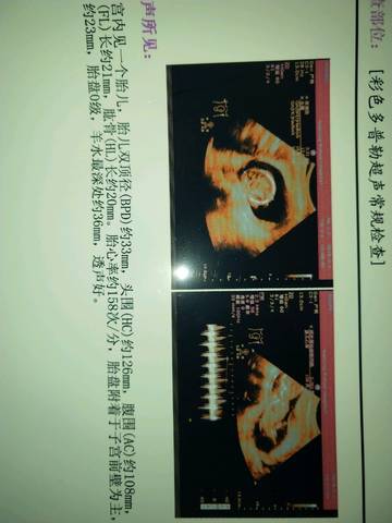 journal_insert_pic_937443426
