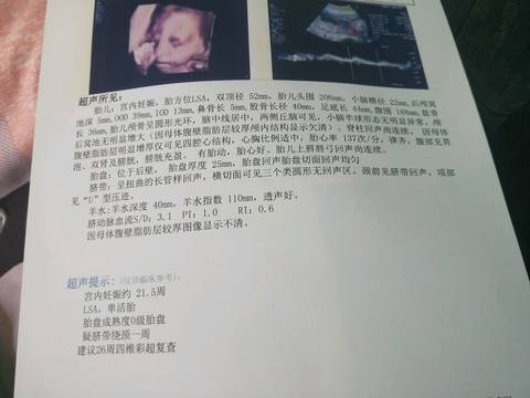 journal_insert_pic_937768934