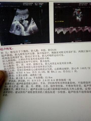 journal_insert_pic_938324629