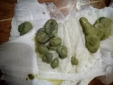 我的宝宝的大便便是这样正常吗