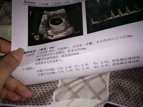 journal_insert_pic_939579303