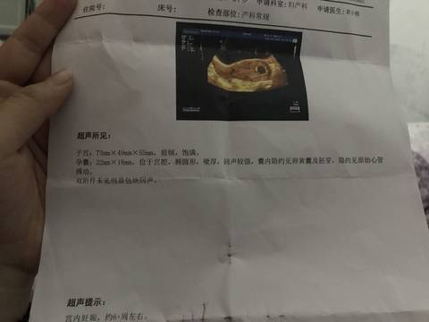 journal_insert_pic_942340555