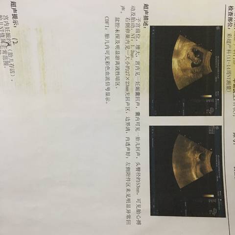 journal_insert_pic_944187393