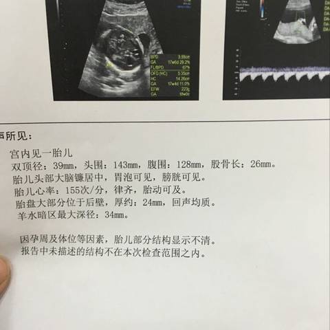 journal_insert_pic_943909234