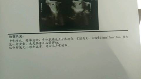 journal_insert_pic_944058904