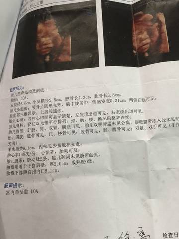 journal_insert_pic_949657838