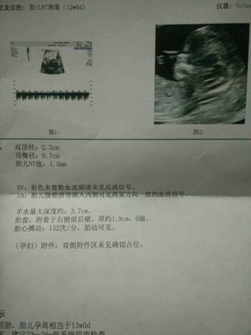 journal_insert_pic_949781784
