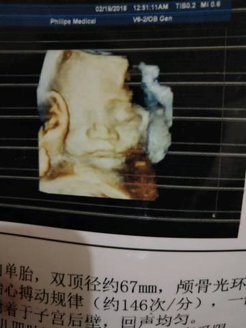 journal_insert_pic_951757442