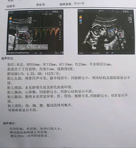 journal_insert_pic_951473974