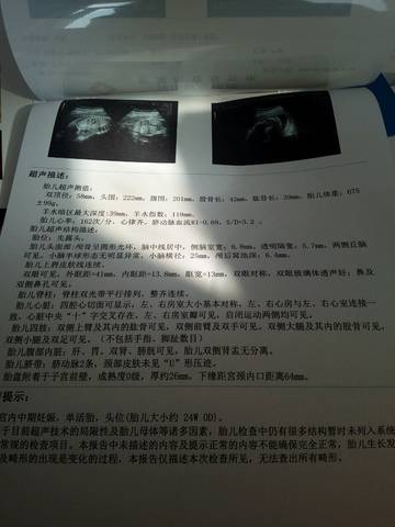 journal_insert_pic_951473047