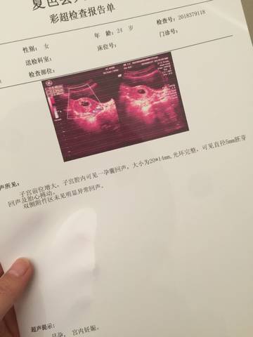 journal_insert_pic_954420164
