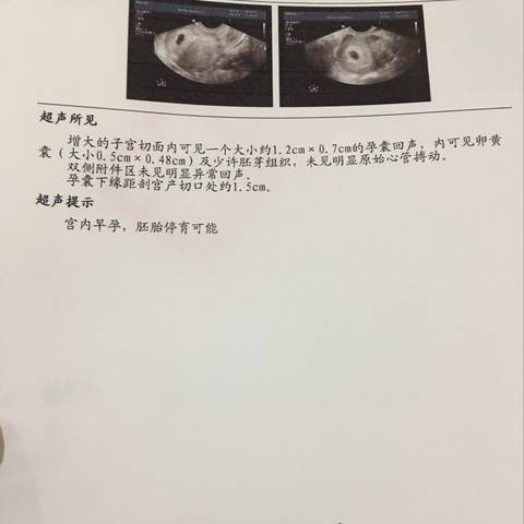 journal_insert_pic_957314316