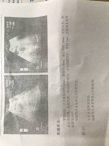 journal_insert_pic_958210752