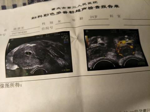 journal_insert_pic_960728565