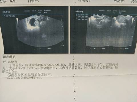 journal_insert_pic_961152613