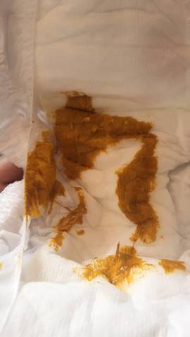 宝宝50天了,上一次拉粑粑是在2.