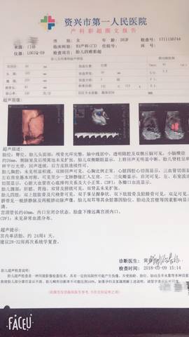 journal_insert_pic_962954692