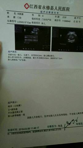 journal_insert_pic_963501061