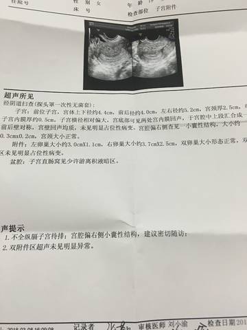 journal_insert_pic_963832140