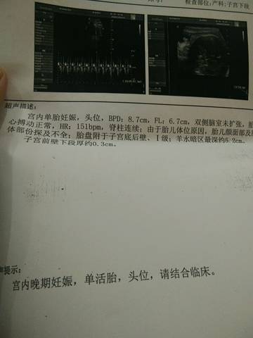 journal_insert_pic_966064876