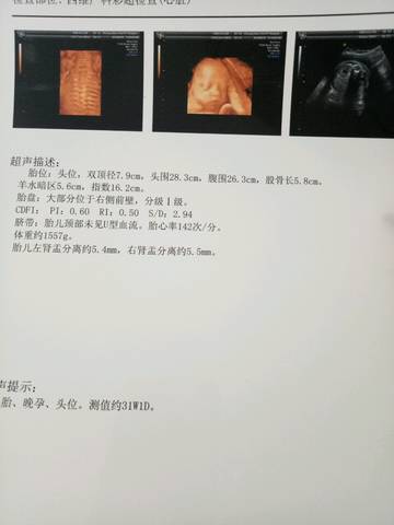 journal_insert_pic_967234042