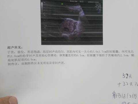 journal_insert_pic_967580384