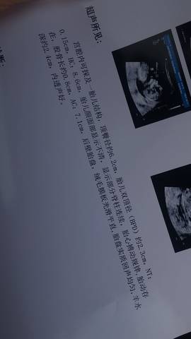 journal_insert_pic_968394230