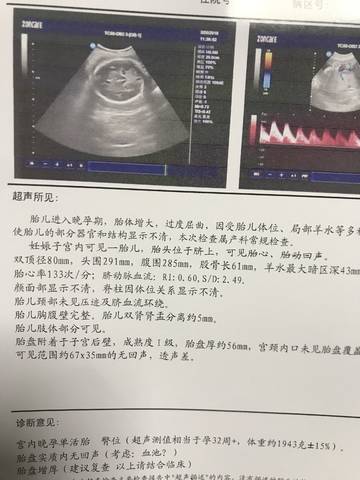 journal_insert_pic_971016897
